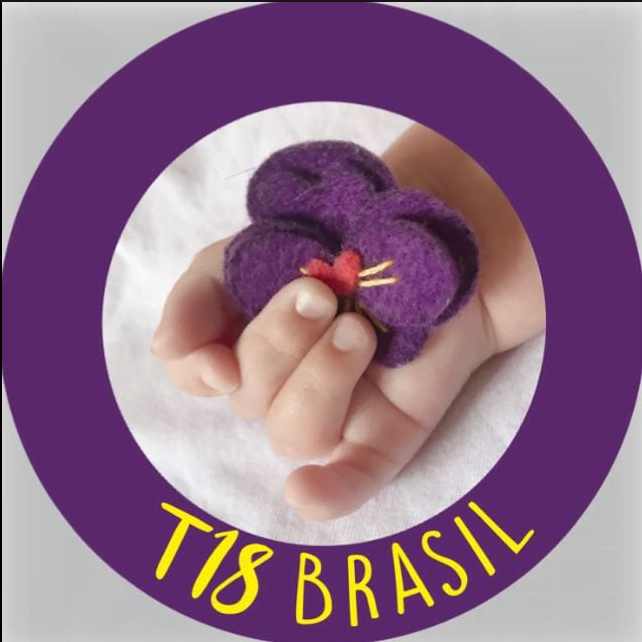 Saiba o que é a Síndrome de Edwards