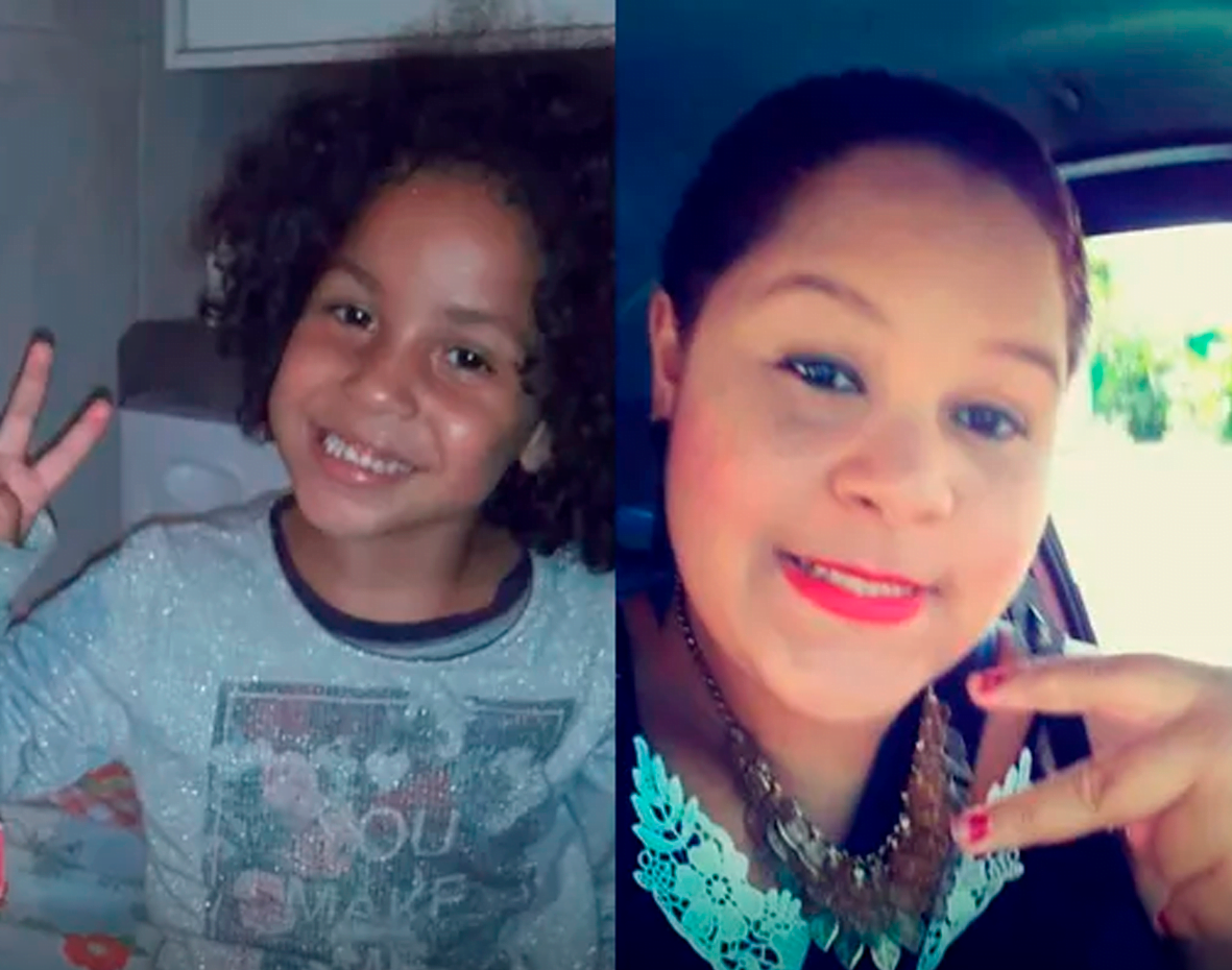 Menina que teve perna amputada depende de doações para reforma da casa e próteses