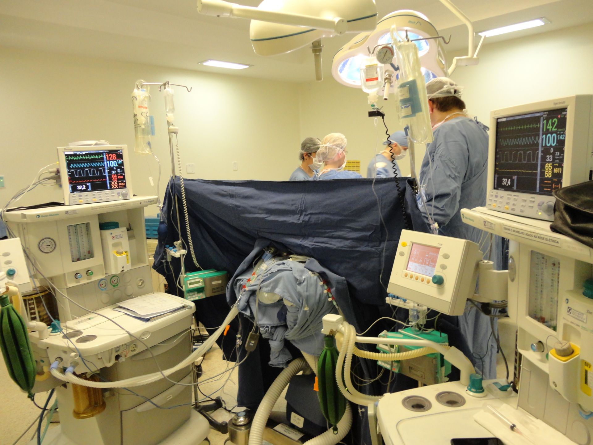 Separação das siamesas: cirurgia final acontecerá neste sábado no HC de Ribeirão