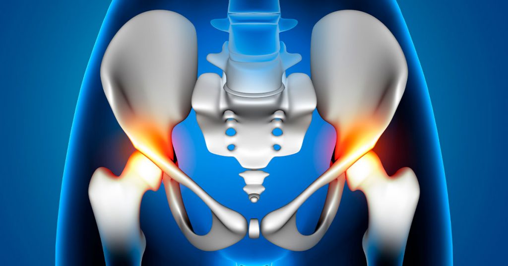 os-diferentes-tipos-de-cirurgia-de-quadril-e-suas-indicacoes-1024x536-1