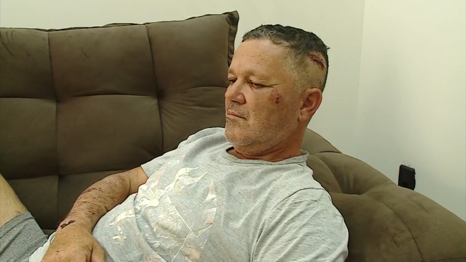 Diretor da prefeitura de Jaguariúna tem alta após agressão