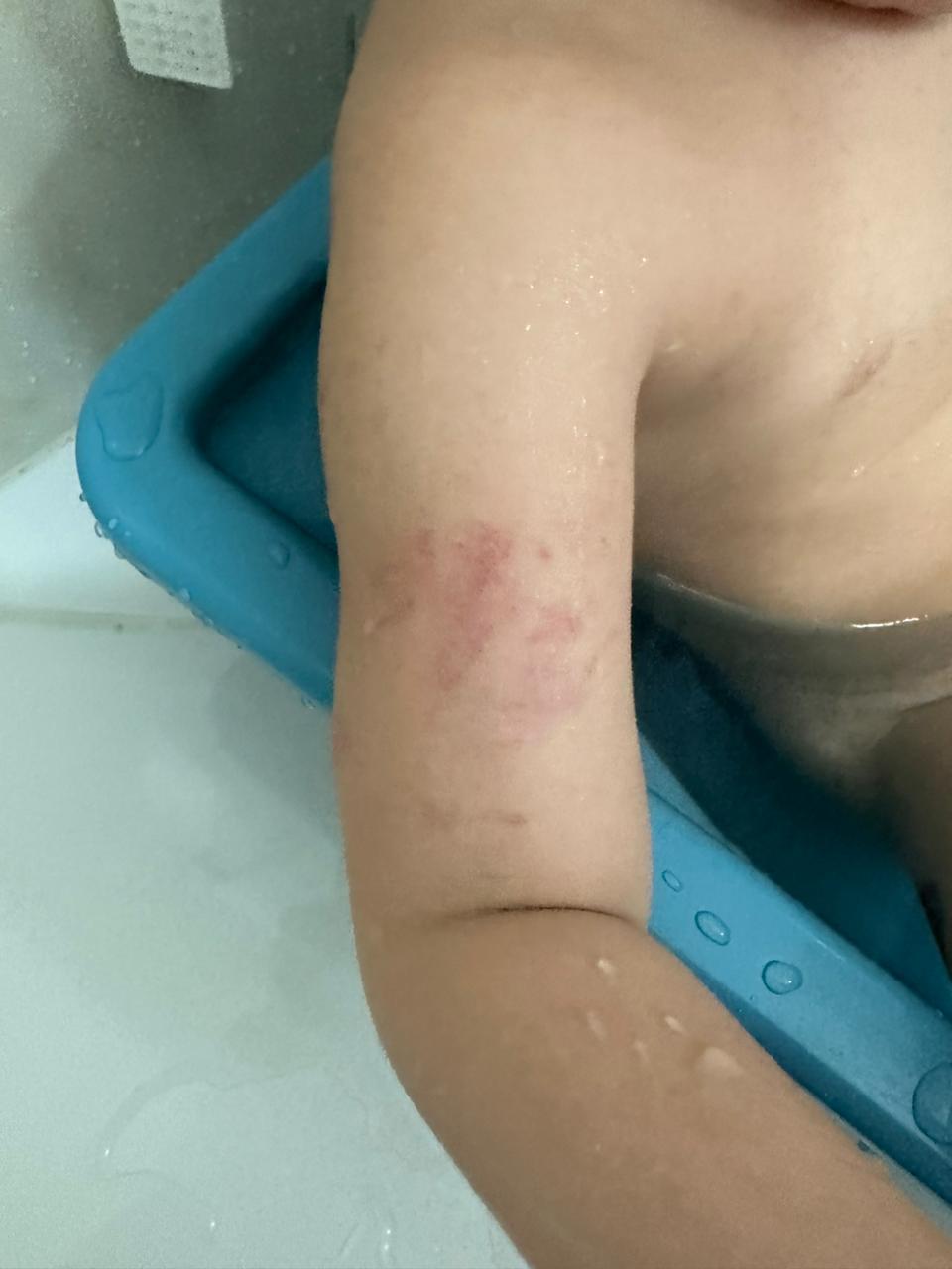 agressão criança autista taubaté agressão criança autista taubaté