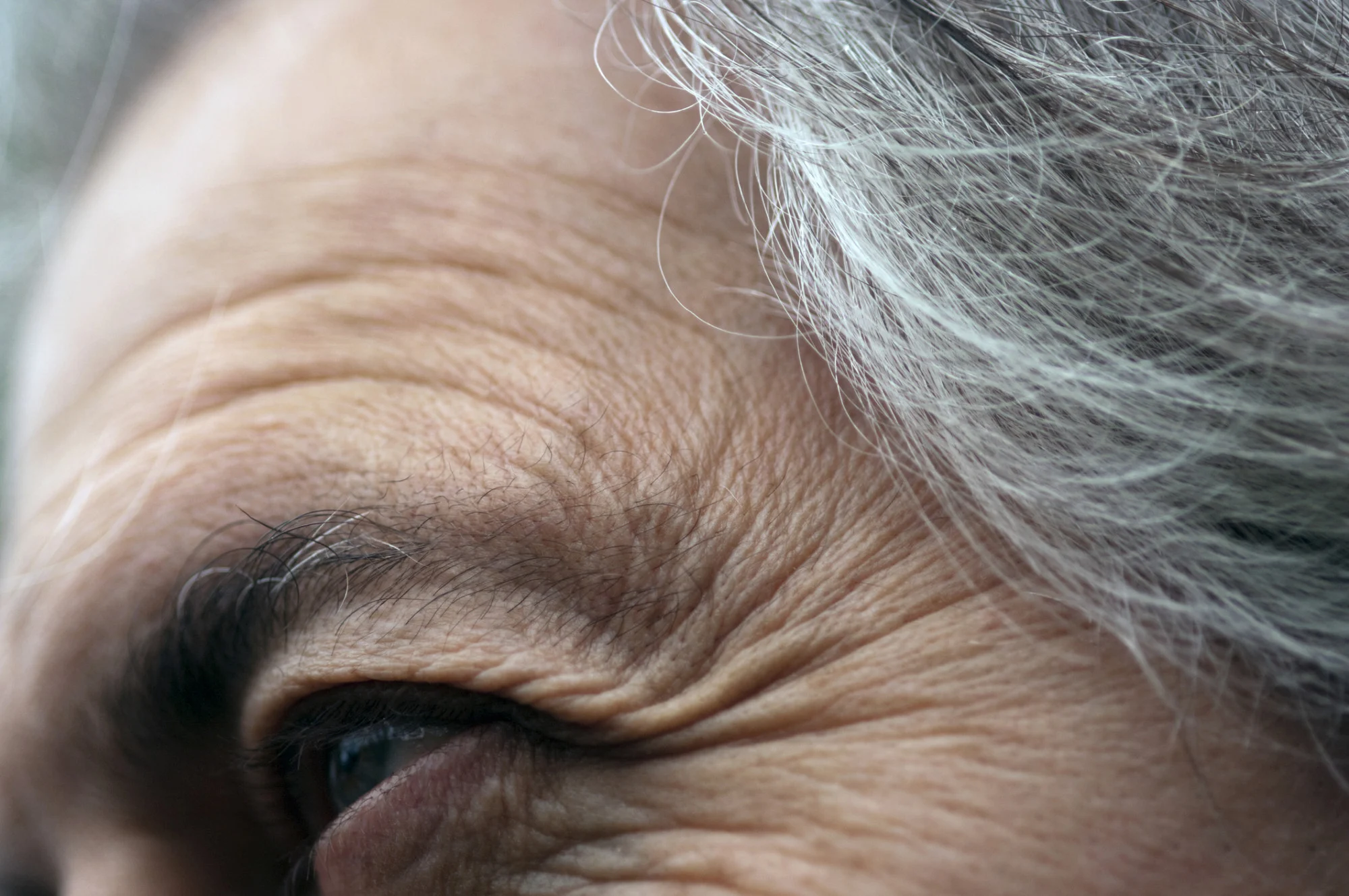 Cremes e procedimentos prometem melhorar rugas a curto prazo